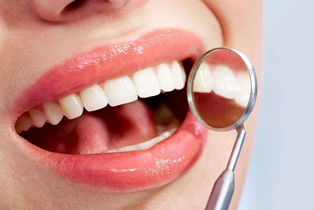 Blanqueamiento dental en consultorio